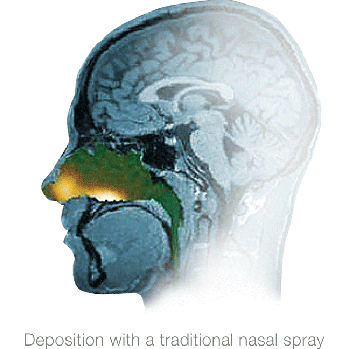 scintigraphy-animation scintigraphy-animation