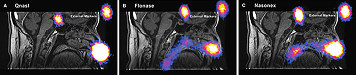 image_nasal_deliv image_nasal_deliv